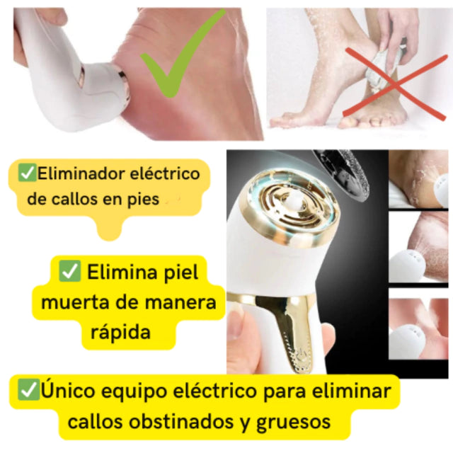 Eliminador de callos